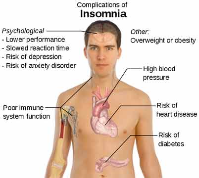 This chart shows the different complications of insomnia