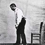 This parkinsons patient was photographed circa 1892 - Public Domain Photo