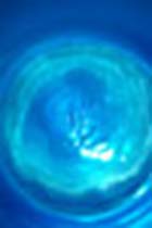 drinking enough water can help prevent many health conditions