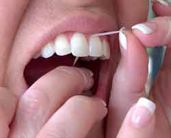 flossing should ideally be done once a day to prevent gum disease. it is best to floss before you go to bed 