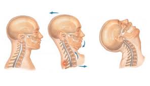 The cervical spine is flexible, allowing the head to move in all directions. It begins at the base of the skull, comprises 7 vertebrae with 8 pairs of cervical nerves.